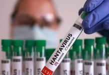 Confirman primer caso de hantavirus en Canadá vinculado a brote en crucero MV Hondius