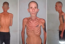 La táctica que Cuba usa para eludir su responsabilidad en la muerte de presos, según un informe de derechos humanos